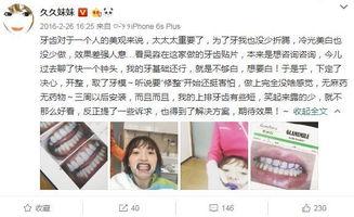 磨牙的明星网红有哪些,揭秘那些“磨牙”高手